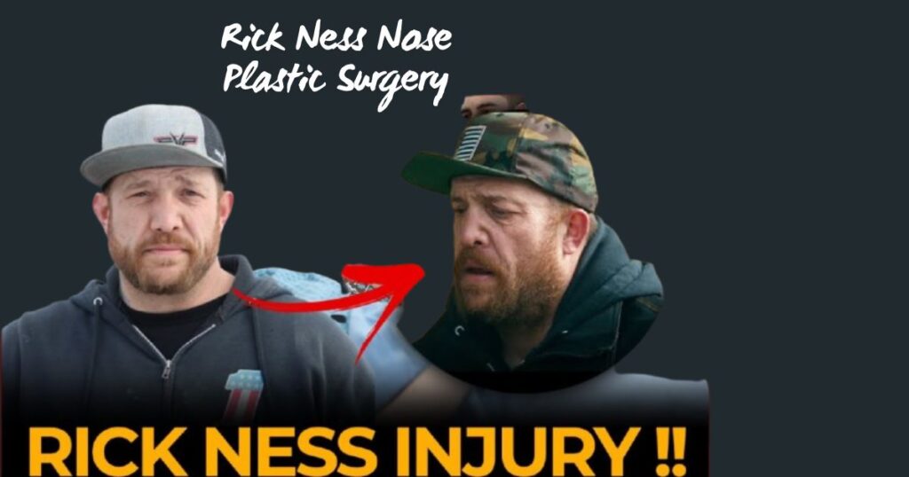 Did Rick Ness Go Under Plastic Surgery?